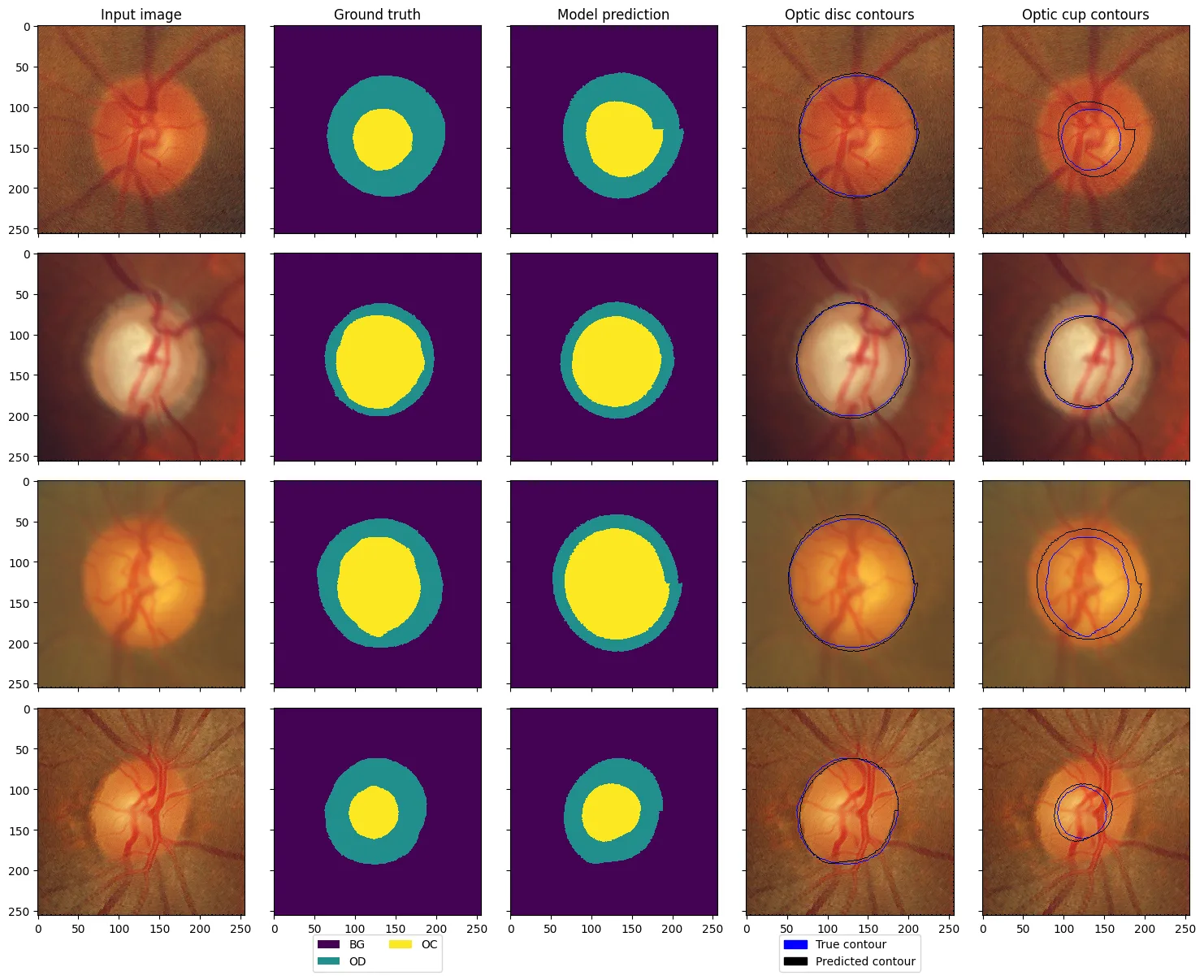 Four eye images with the expert outline, the model prediction and both contours overlaid