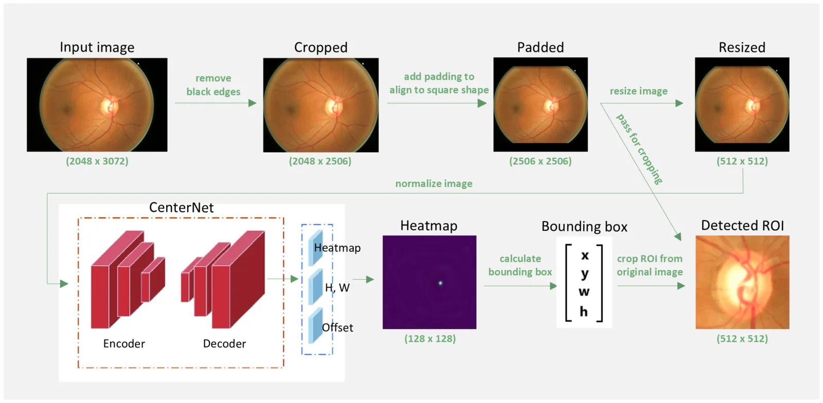 Processing steps from a raw eye image to the detected optic disc